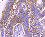MVP Antibody in Immunohistochemistry (Paraffin) (IHC (P))