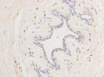 Cyclin E2 Antibody in Immunohistochemistry (Paraffin) (IHC (P))