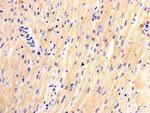 JPH2 Monoclonal Antibody (3-2)