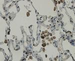 C19orf35 Antibody in Immunohistochemistry (Paraffin) (IHC (P))