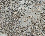 CCDC51 Antibody in Immunohistochemistry (Paraffin) (IHC (P))