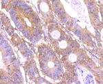 HECTD4 Antibody in Immunohistochemistry (Paraffin) (IHC (P))