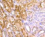 HECTD4 Antibody in Immunohistochemistry (Paraffin) (IHC (P))