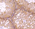 HECTD4 Antibody in Immunohistochemistry (Paraffin) (IHC (P))