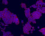TMEM200A Antibody in Immunocytochemistry (ICC/IF)