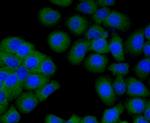 TMEM200A Antibody in Immunocytochemistry (ICC/IF)