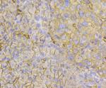 TMEM200A Antibody in Immunohistochemistry (Paraffin) (IHC (P))
