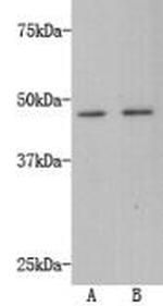 TMEM200A Antibody in Western Blot (WB)