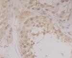 GRAMD1A Antibody in Immunohistochemistry (Paraffin) (IHC (P))