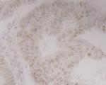 GRAMD1A Antibody in Immunohistochemistry (Paraffin) (IHC (P))