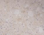 GRAMD1A Antibody in Immunohistochemistry (Paraffin) (IHC (P))