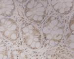 GRAMD1A Antibody in Immunohistochemistry (Paraffin) (IHC (P))