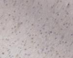 GRAMD1A Antibody in Immunohistochemistry (Paraffin) (IHC (P))