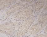 GRAMD1A Antibody in Immunohistochemistry (Paraffin) (IHC (P))