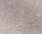 GRAMD1A Antibody in Immunohistochemistry (Paraffin) (IHC (P))