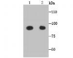GRAMD1A Antibody in Western Blot (WB)