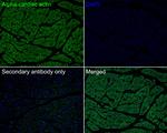 alpha-Cardiac Actin Antibody in Immunohistochemistry (Paraffin) (IHC (P))