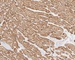 alpha-Cardiac Actin Antibody in Immunohistochemistry (Paraffin) (IHC (P))