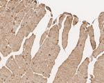 alpha-Cardiac Actin Antibody in Immunohistochemistry (Paraffin) (IHC (P))