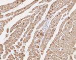 alpha-Cardiac Actin Antibody in Immunohistochemistry (Paraffin) (IHC (P))
