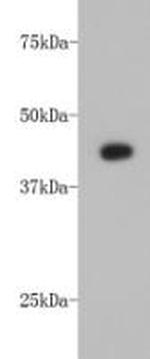 alpha-Cardiac Actin Antibody in Western Blot (WB)