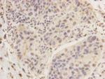 KIAA0100 Antibody in Immunohistochemistry (Paraffin) (IHC (P))
