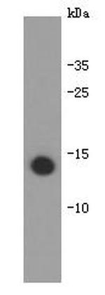 IL-31 Monoclonal Antibody (B7-B0)
