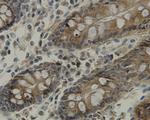 TMEM177 Antibody in Immunohistochemistry (Paraffin) (IHC (P))