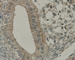 TMEM177 Antibody in Immunohistochemistry (Paraffin) (IHC (P))