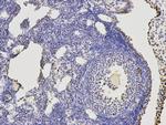 KLDC3 Antibody in Immunohistochemistry (Paraffin) (IHC (P))