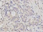 BRCA2 Antibody in Immunohistochemistry (Paraffin) (IHC (P))