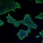 LIN28B Monoclonal Antibody (A2-4-5)