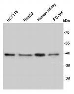 REM2 Antibody in Western Blot (WB)