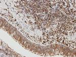 SIRT1 Antibody in Immunohistochemistry (Paraffin) (IHC (P))
