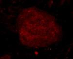 C19orf35 Monoclonal Antibody (3-B7)