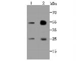 AK6 Antibody in Western Blot (WB)