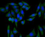 PI3K p85 alpha Monoclonal Antibody (A3-D0)