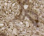 EFTUD2 Antibody in Immunohistochemistry (Paraffin) (IHC (P))