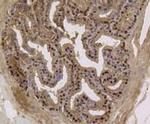 EFTUD2 Antibody in Immunohistochemistry (Paraffin) (IHC (P))