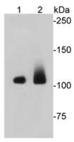 EFTUD2 Antibody in Western Blot (WB)