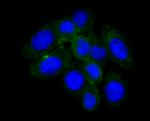 Haptoglobin Monoclonal Antibody (5-D3)
