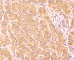 Haptoglobin Antibody in Immunohistochemistry (Paraffin) (IHC (P))