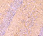 LRRK1 Antibody in Immunohistochemistry (Paraffin) (IHC (P))