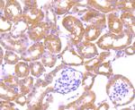 LRRK1 Antibody in Immunohistochemistry (Paraffin) (IHC (P))