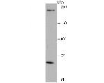 LRRK1 Antibody in Western Blot (WB)
