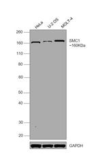 SMC1 Monoclonal Antibody (5E10)