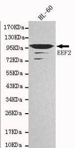 EEF2 Monoclonal Antibody (7F8)