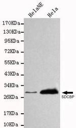 Syntenin 1 Antibody in Western Blot (WB)