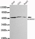 ALDH3A2 Antibody in Western Blot (WB)