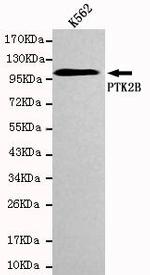 PYK2 Monoclonal Antibody (7A2)